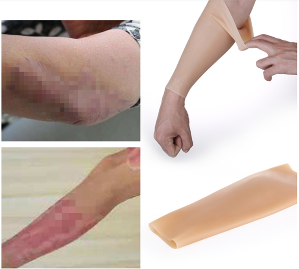 ふくらはぎ/腕カバー　皮膚の傷跡　刺青　ほくろ隠　右左1ペア　男女兼用-2